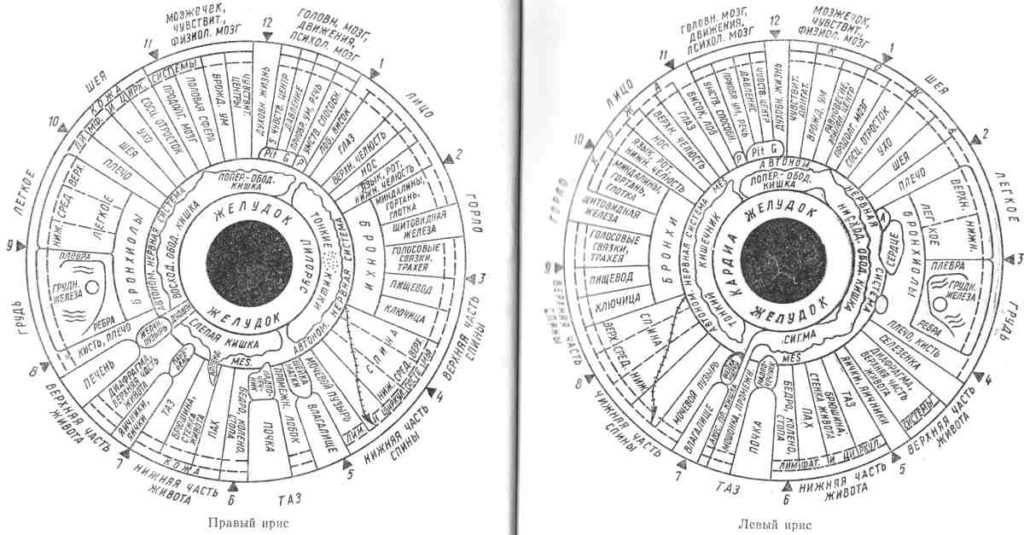 Иридодиагностика фото с расшифровкой