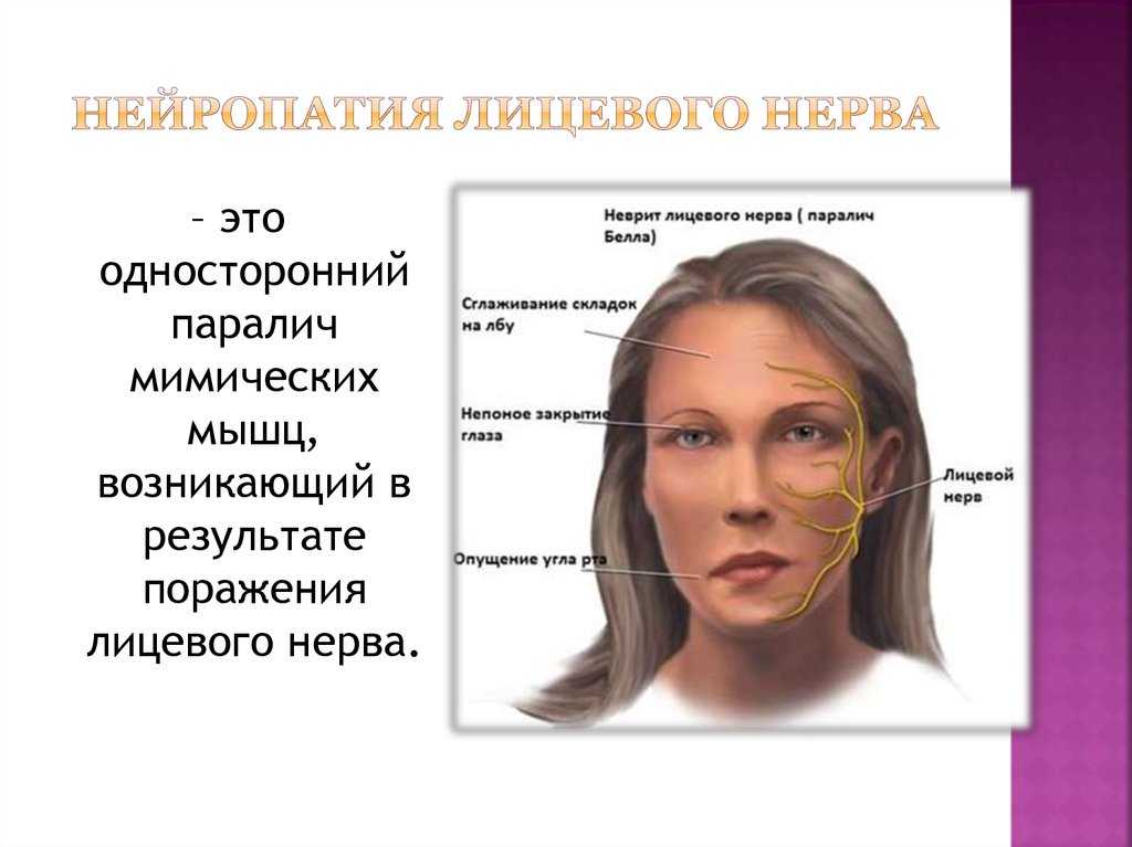 Невроз лица: симптомы и признаки, почему происходит онемение лицевых мышц, что такое парестезия лица, лечение